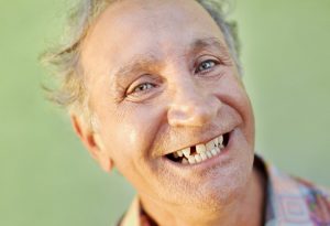 אובדן שיניים אצל מבוגרים