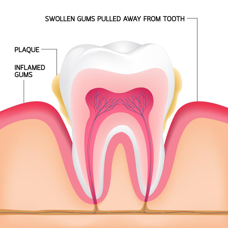 מבנה השיניים והחניכיים